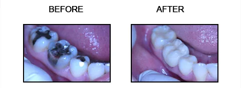 Before and after smile gallery case 8