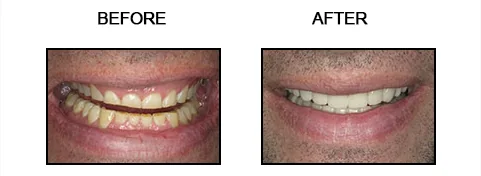 Before and after smile gallery case 10